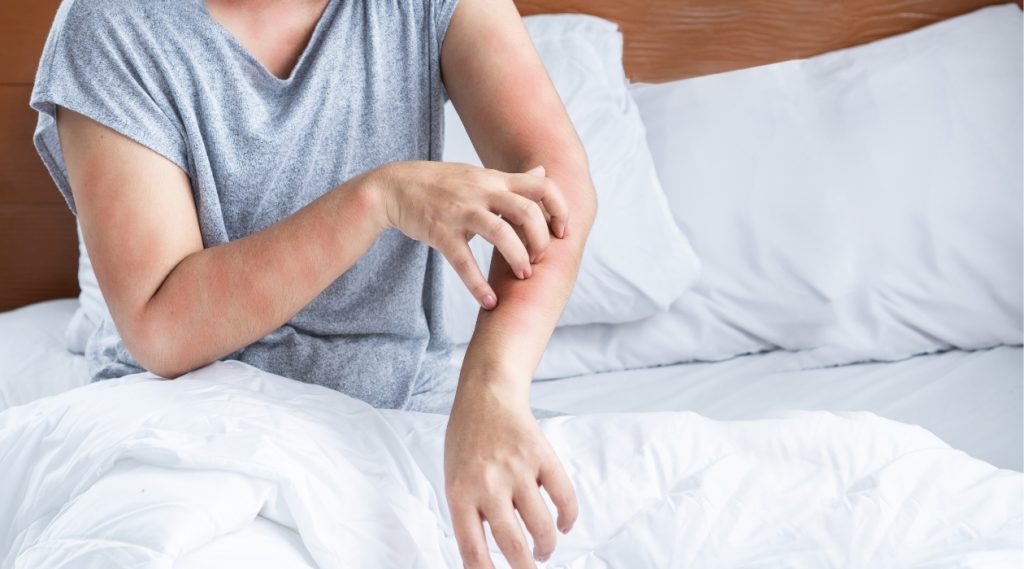 Person scratching their arm